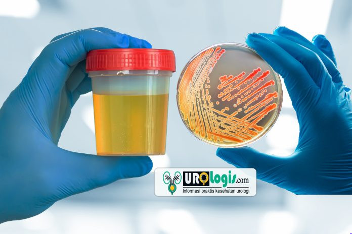 Kultur urine - urologis.com