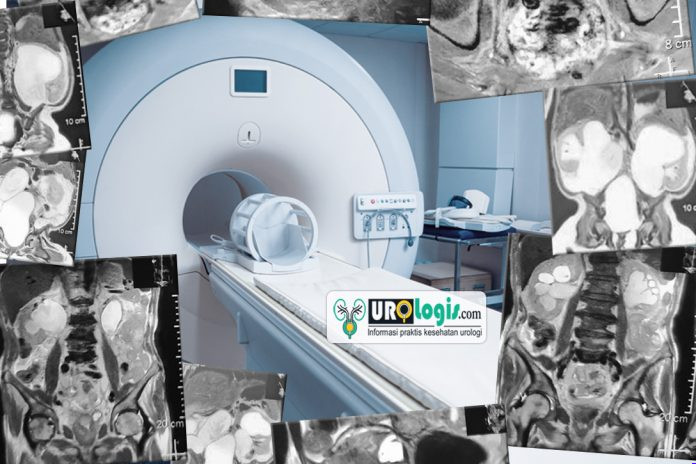 MRI - urologis.com