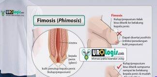 Phimosis (Fimosis): Kulit penutup penis tidak bisa ditarik ke belakang Fimosis - urologis.com