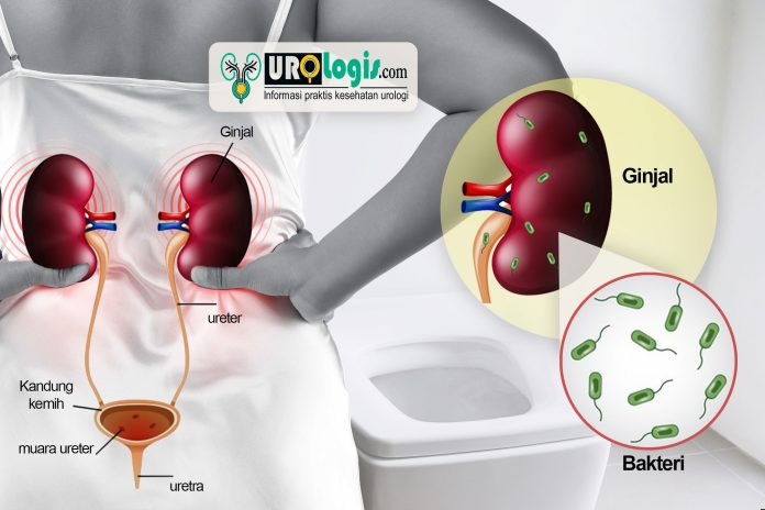 Pyelonefritis - urologis.com