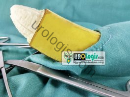 Sunat (Sirkumsisi) Sirkumsisi - urologis.com