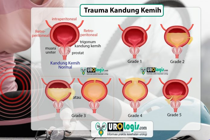 Trauma Kandung Kemih/Buli - urologis.com